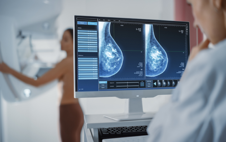 Mammography - OHIP Program